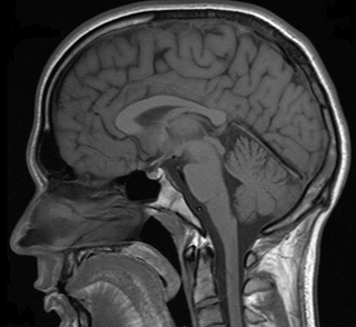 Illustration for article titled Don't Waste Your Money on "Brain Training" Schemes
